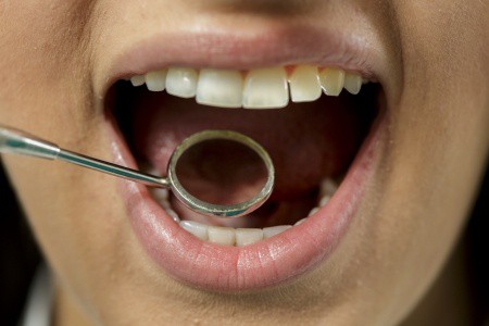 dentist appointment teeth
